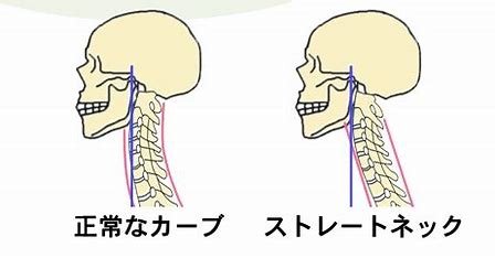 頸椎の正常な構造